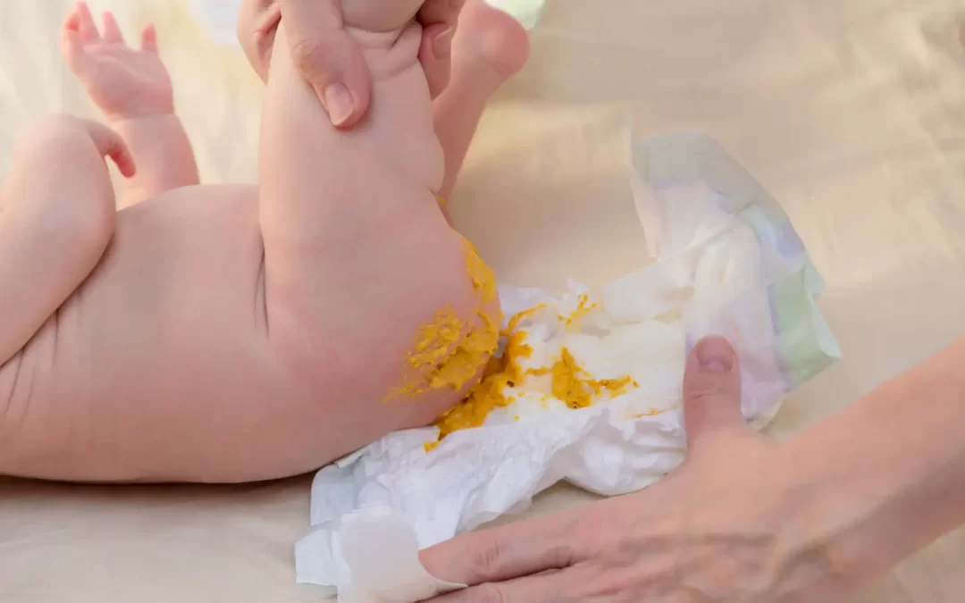 Baby poo colour – what it means